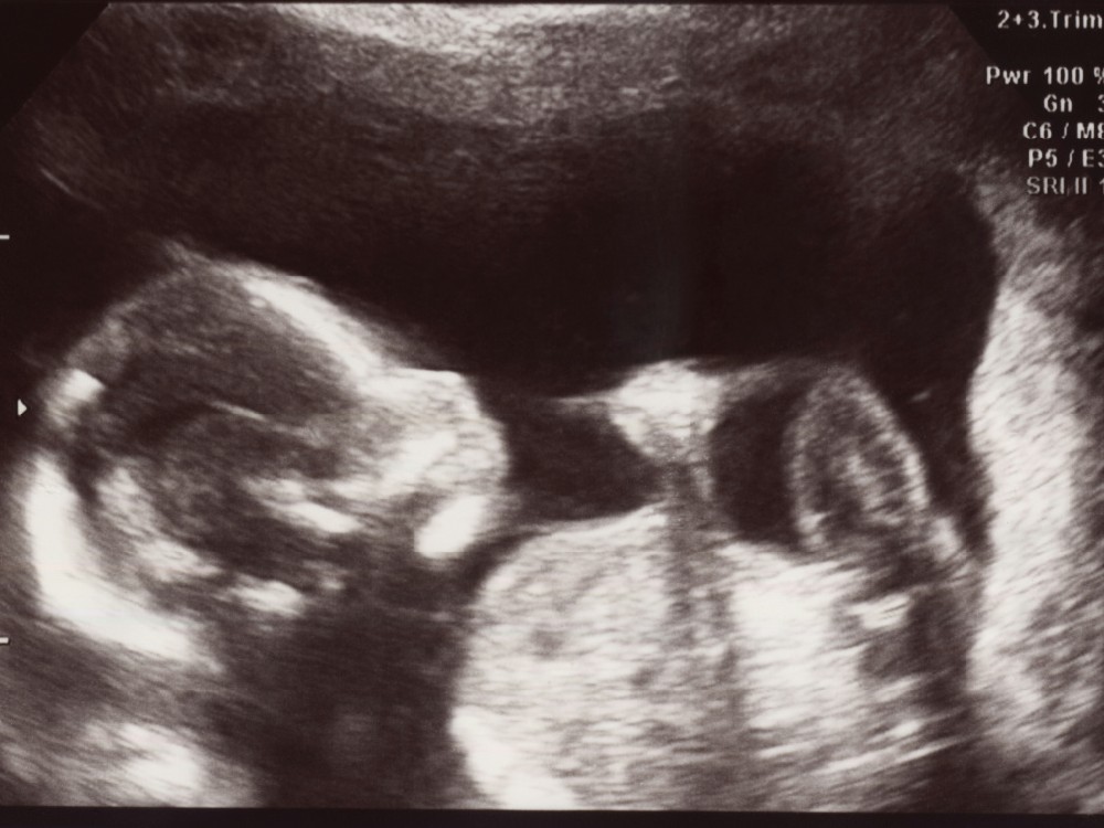 美国代孕：道德與法律